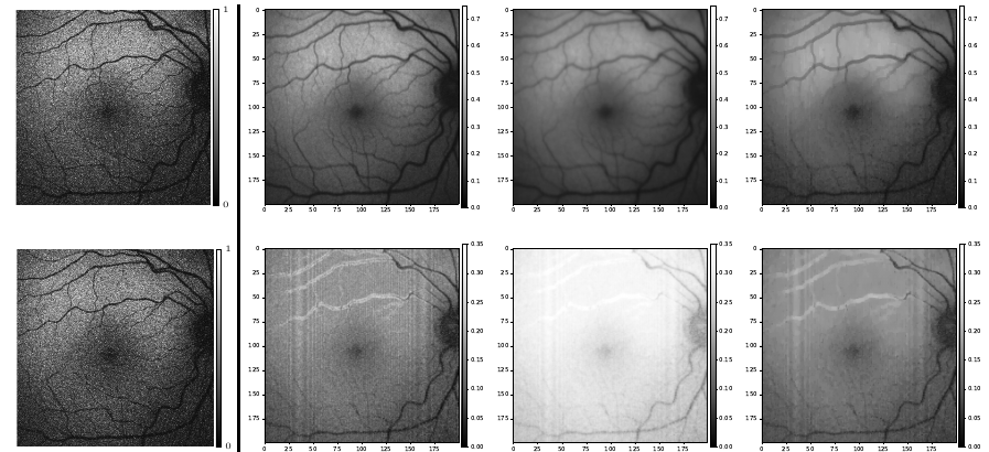 Figure 3: restoration of the estimated mean and standard deviation of retinal scans.