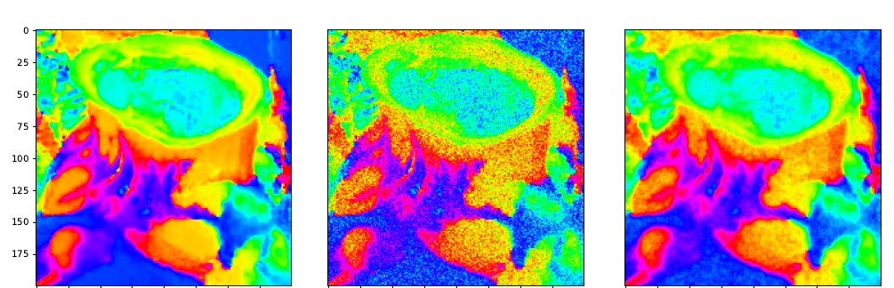 Figure 5: clean, noisy and restored hue of the coral image.